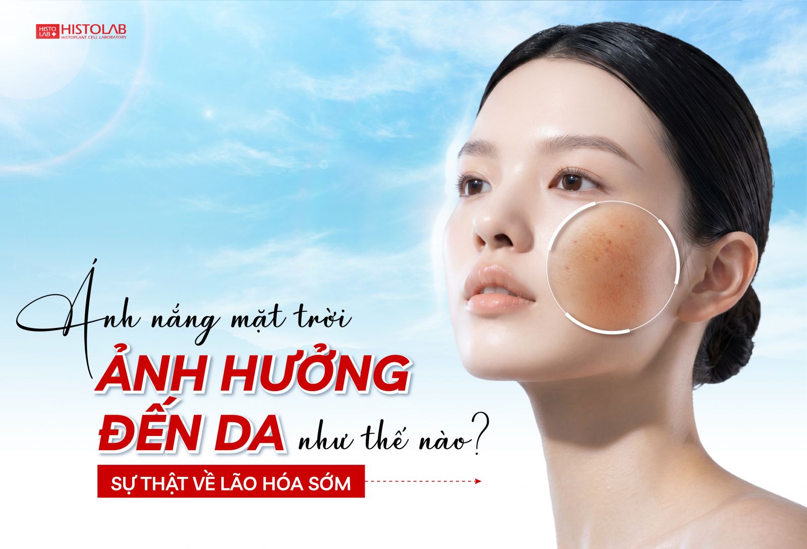ÁNH NẮNG MẶT TRỜI ẢNH HƯỞNG ĐẾN DA NHƯ THẾ NÀO?
