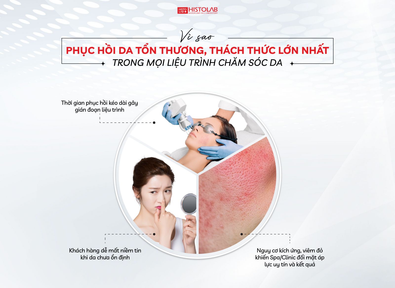 phuc-hoi-da-ton-thuong