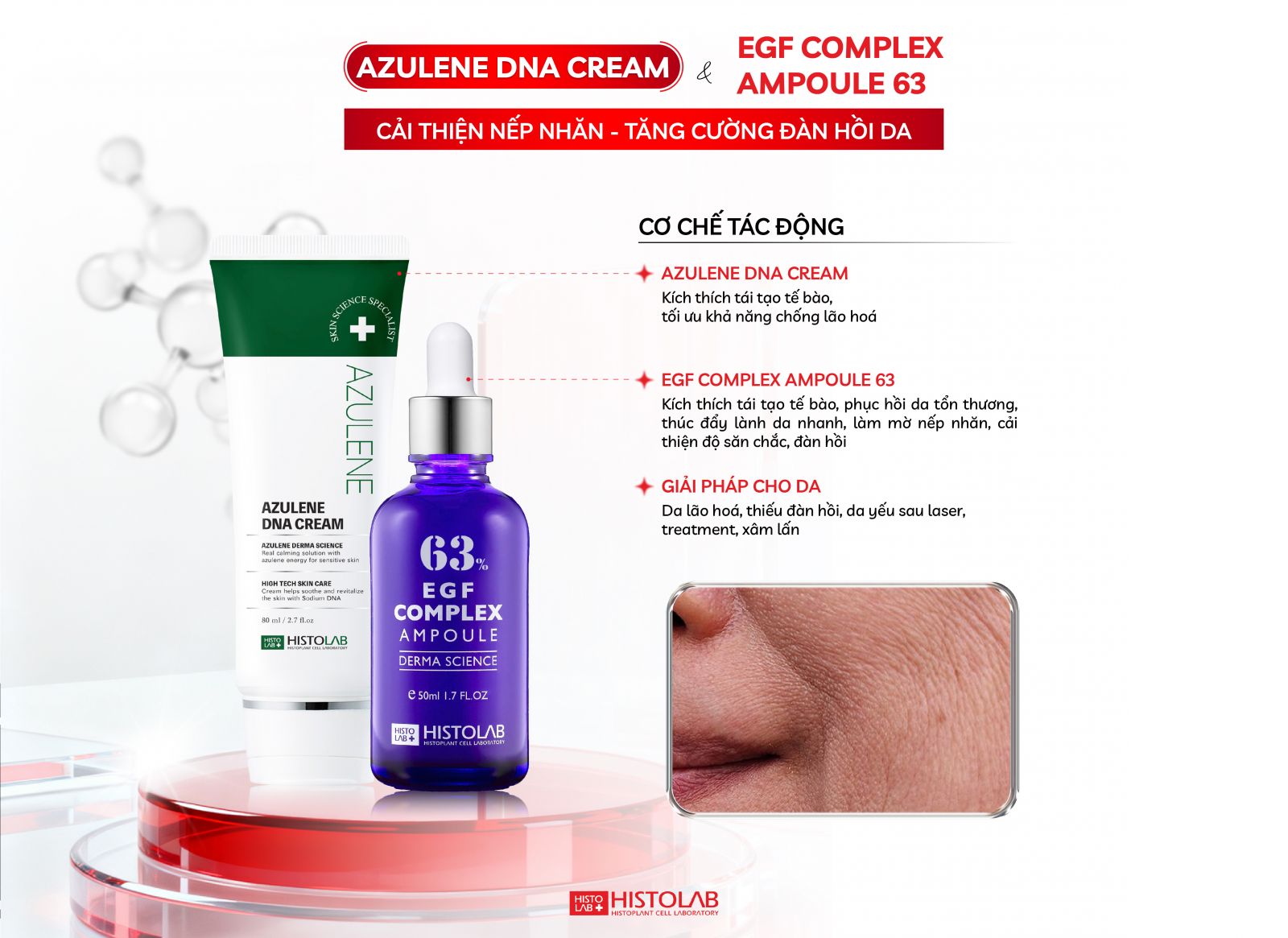 phuc-hoi-ket-hop-ngan-ngua-lao-hoa