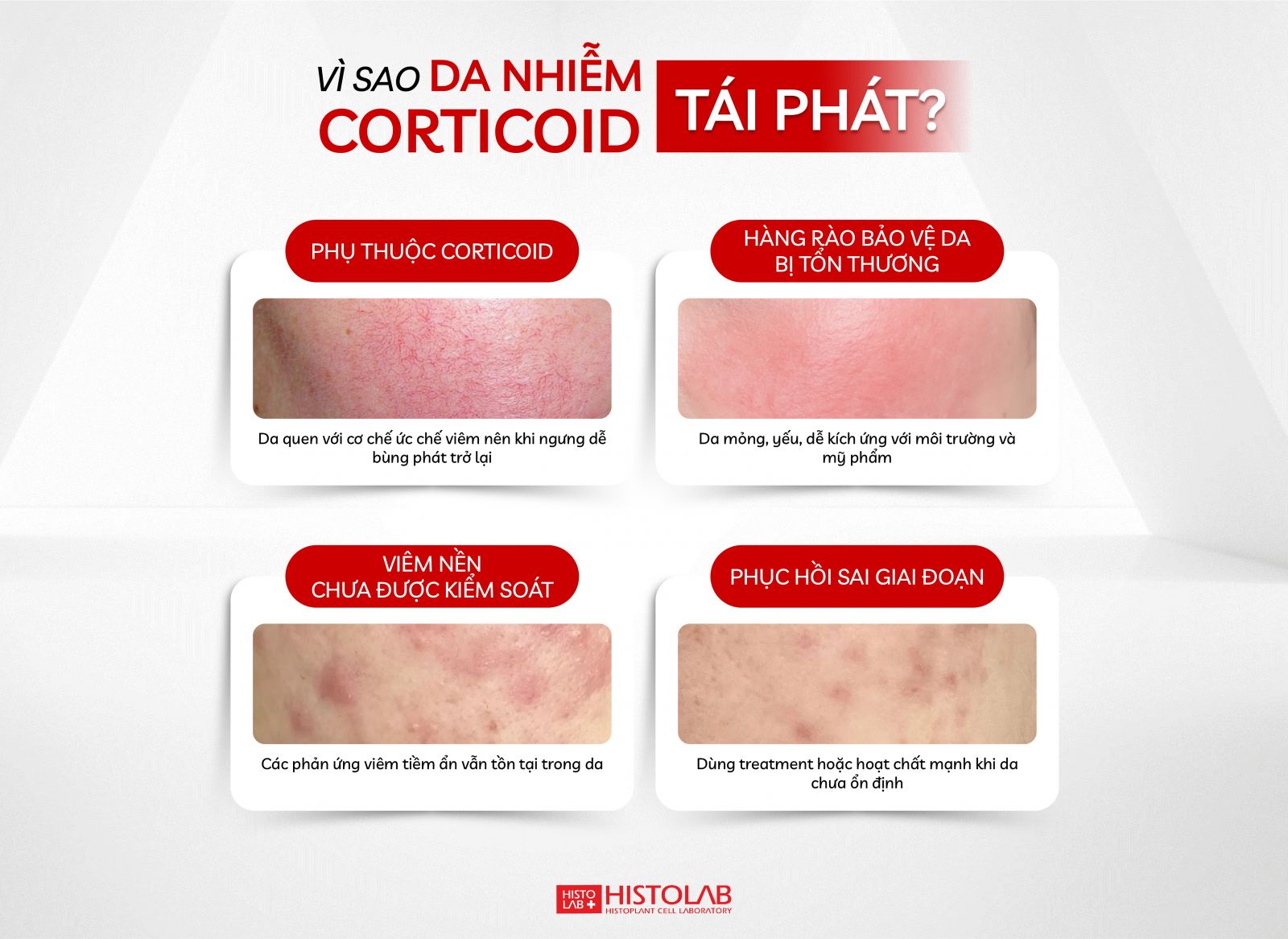vi-sao-da-nhiem-corticoid-tai-phat