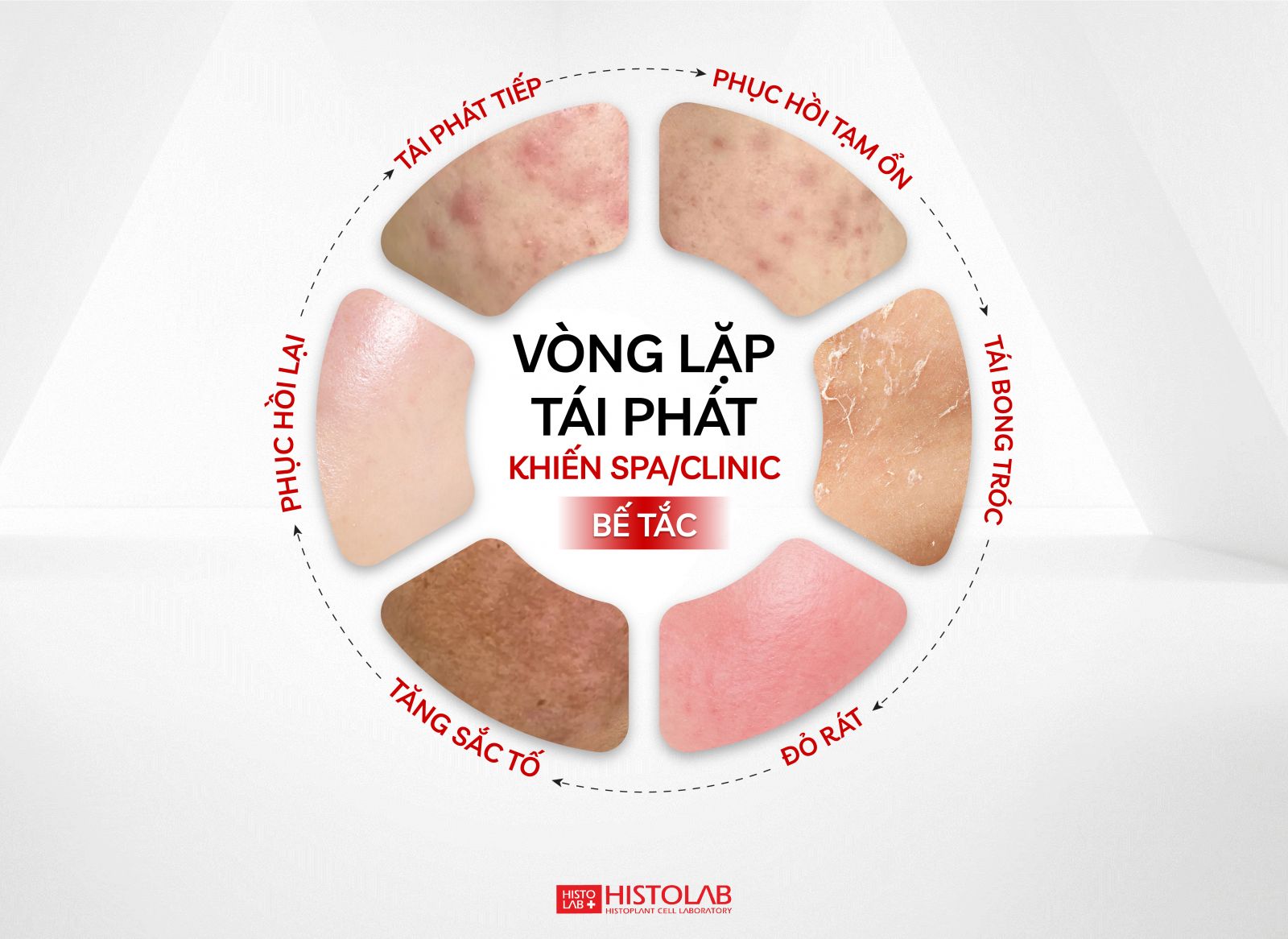 vong-lap-tai-phat-khien-spa-clinic-de-be-tac