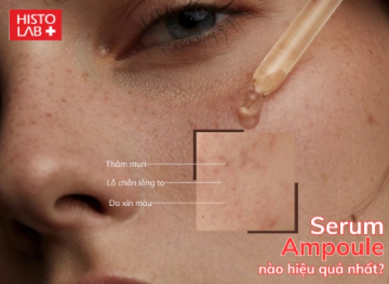 Da bị thâm sau mụn: Serum, ampoule nào hiệu quả nhất?